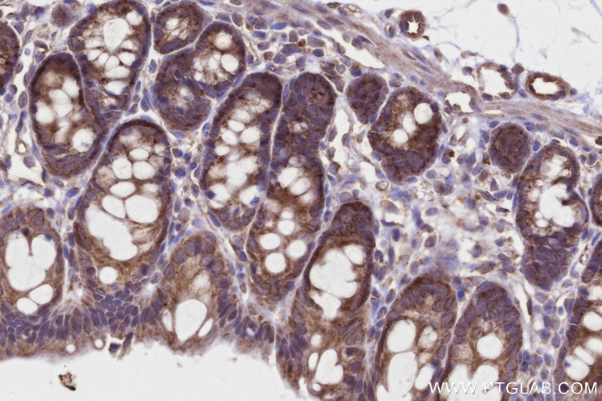 Immunohistochemistry (IHC) staining of rat colon tissue using MRPS22 Polyclonal antibody (10984-1-AP)