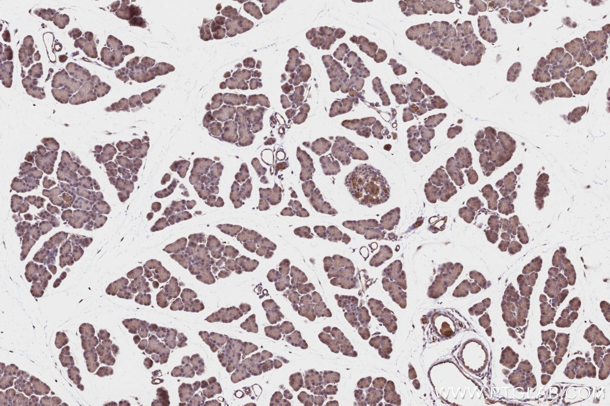 Immunohistochemistry (IHC) staining of rat pancreas tissue using MRPS22 Polyclonal antibody (10984-1-AP)