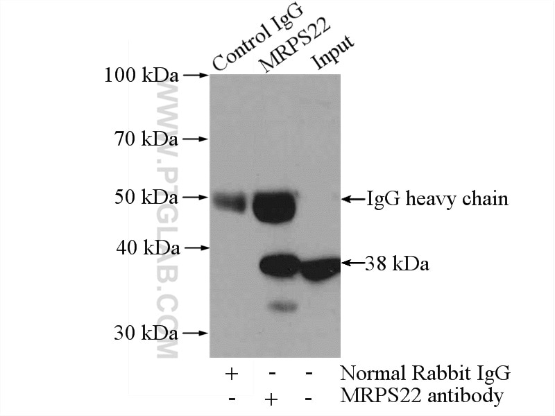 IP experiment of Jurkat using 10984-1-AP