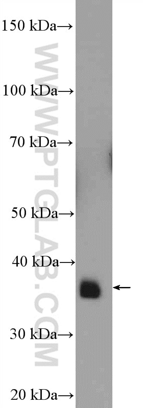 WB analysis of mouse liver using 10984-1-AP