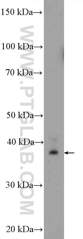 Western Blot (WB) analysis of mouse spleen tissue using MRPS22 Polyclonal antibody (10984-1-AP)
