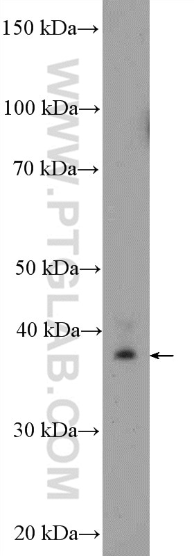 WB analysis of mouse spleen using 10984-1-AP