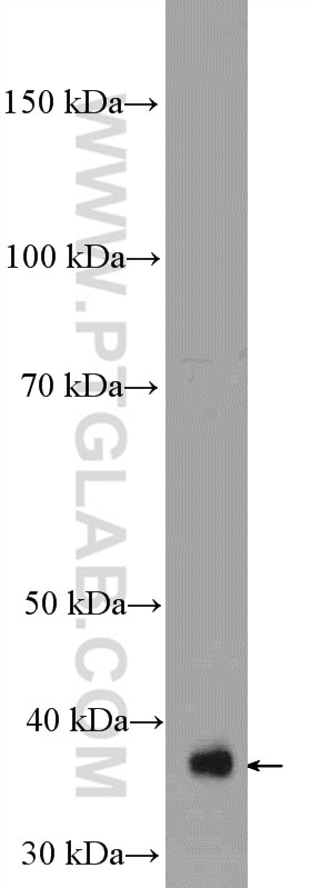 Western Blot (WB) analysis of rat spleen tissue using MRPS22 Polyclonal antibody (10984-1-AP)