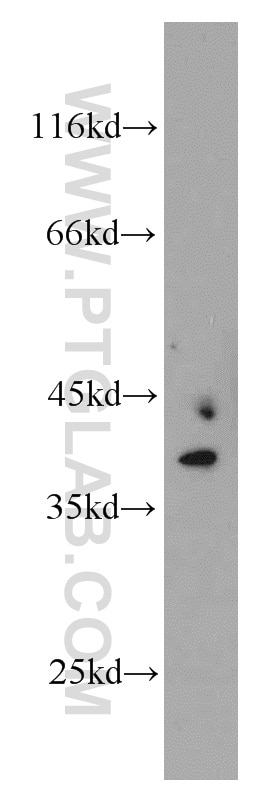 Western Blot (WB) analysis of Jurkat cells using MRPS22 Polyclonal antibody (10984-1-AP)