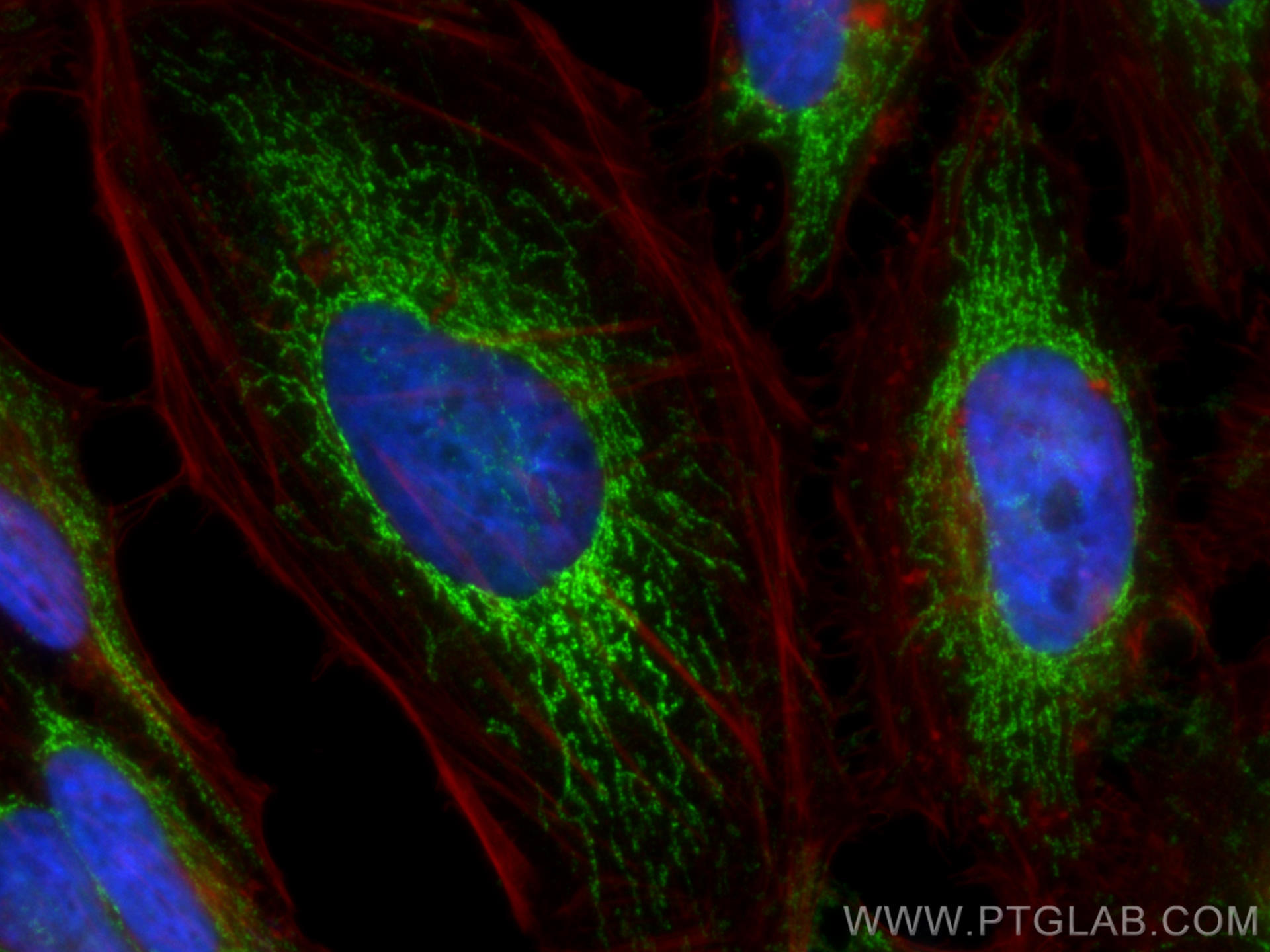 Immunofluorescence (IF) / fluorescent staining of HeLa cells using MRPS23 Polyclonal antibody (18345-1-AP)
