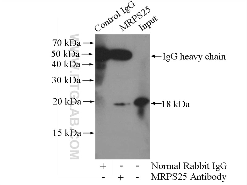 Immunoprecipitation (IP) experiment of HEK-293 cells using MRPS25 Polyclonal antibody (15277-1-AP)