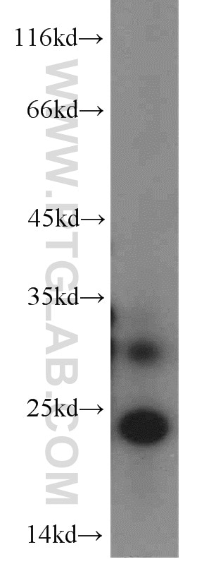 Western Blot (WB) analysis of HeLa cells using MRPS26 Polyclonal antibody (15989-1-AP)