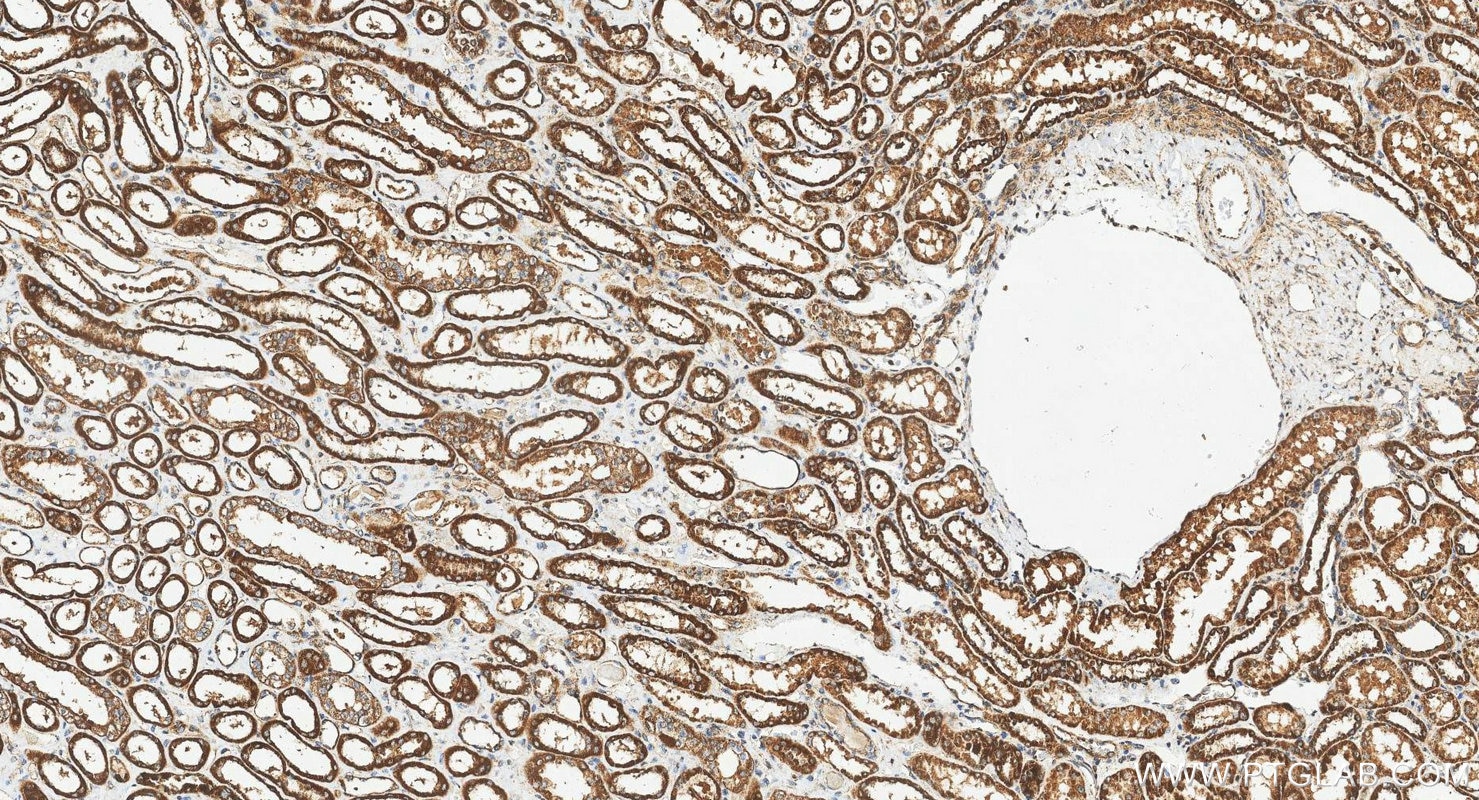 Immunohistochemistry (IHC) staining of human kidney tissue using MRPS27 Polyclonal antibody (17280-1-AP)