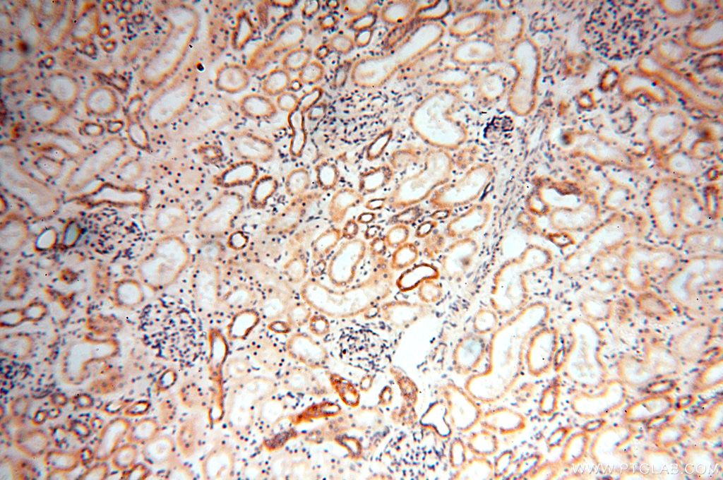 Immunohistochemistry (IHC) staining of human kidney tissue using MRPS27 Polyclonal antibody (17280-1-AP)