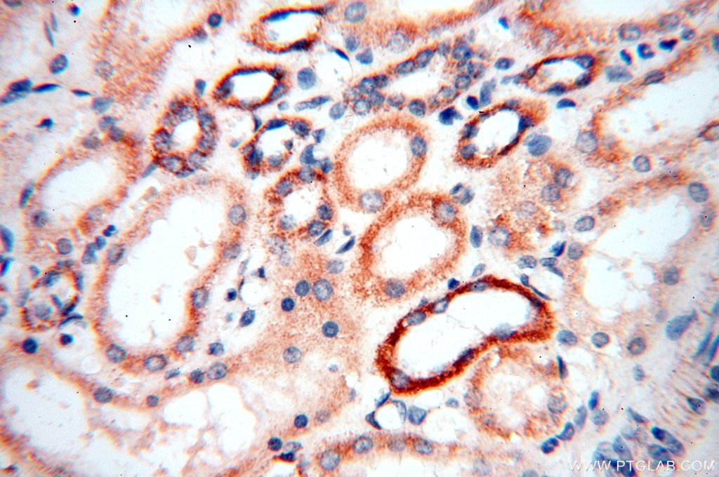 Immunohistochemistry (IHC) staining of human kidney tissue using MRPS27 Polyclonal antibody (17280-1-AP)