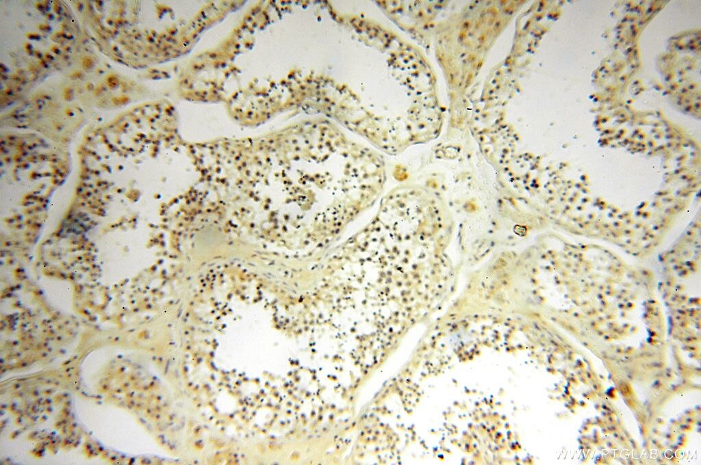 Immunohistochemistry (IHC) staining of human testis tissue using MRPS27 Polyclonal antibody (17280-1-AP)