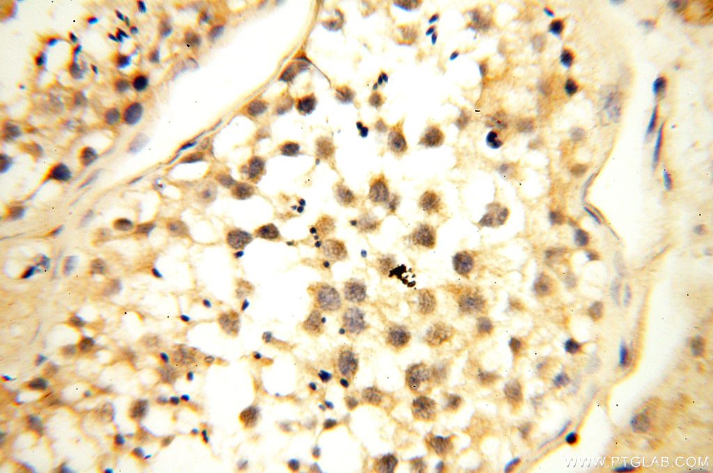 Immunohistochemistry (IHC) staining of human testis tissue using MRPS27 Polyclonal antibody (17280-1-AP)