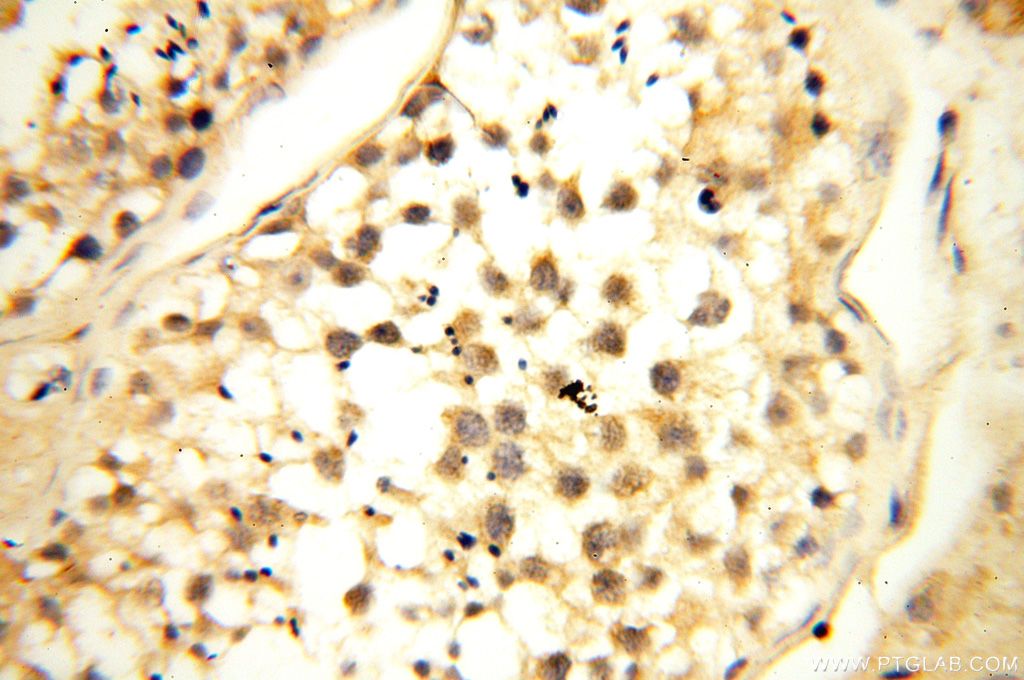 IHC staining of human testis using 17280-1-AP