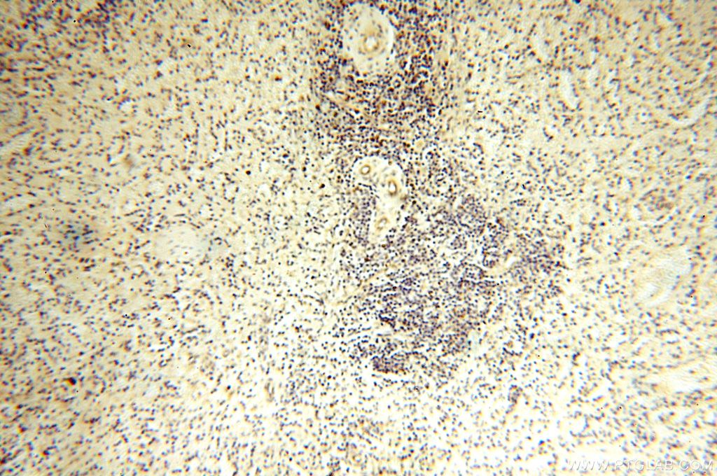 Immunohistochemistry (IHC) staining of human spleen tissue using MRPS27 Polyclonal antibody (17280-1-AP)