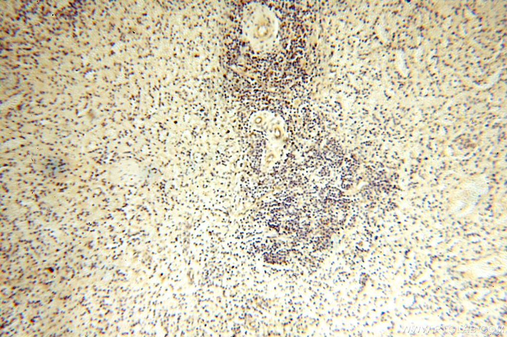 IHC staining of human spleen using 17280-1-AP