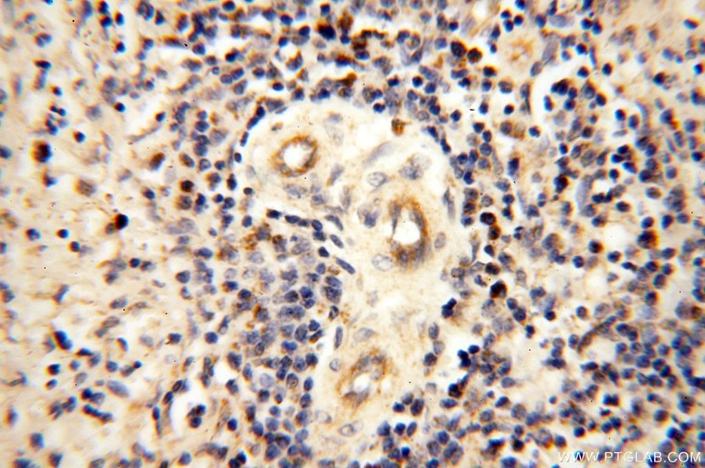 Immunohistochemistry (IHC) staining of human spleen tissue using MRPS27 Polyclonal antibody (17280-1-AP)