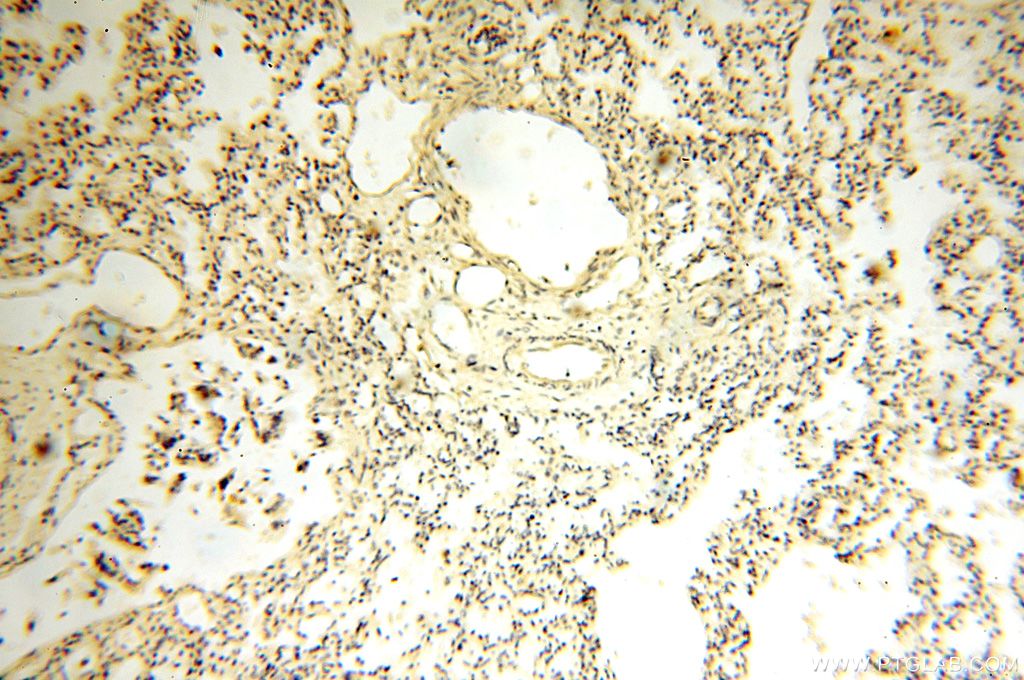 Immunohistochemistry (IHC) staining of human lung tissue using MRPS27 Polyclonal antibody (17280-1-AP)