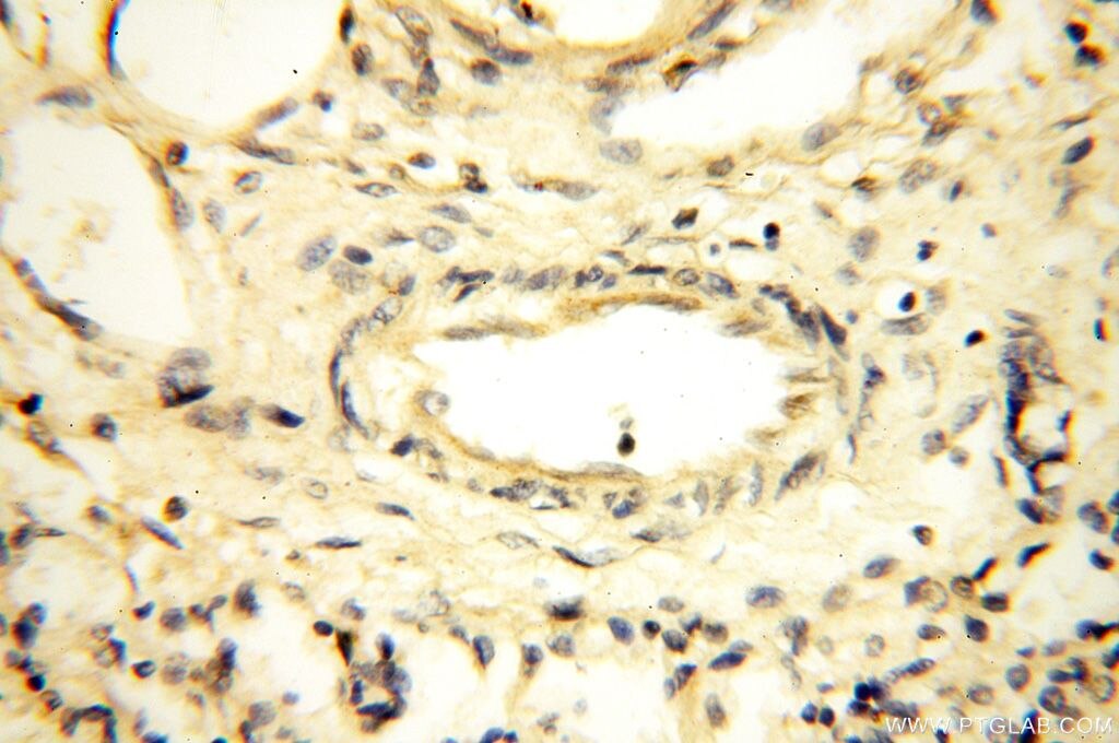 Immunohistochemistry (IHC) staining of human lung tissue using MRPS27 Polyclonal antibody (17280-1-AP)