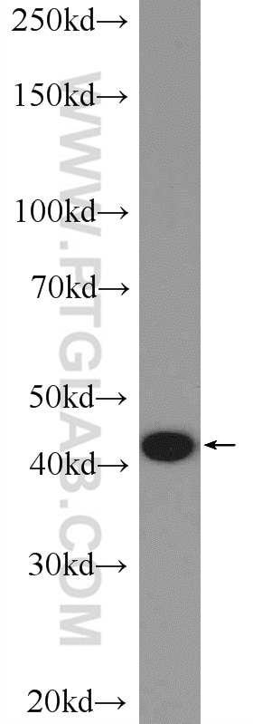 Western Blot (WB) analysis of A431 cells using MRPS27 Polyclonal antibody (17280-1-AP)