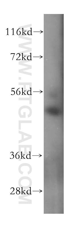 WB analysis of human skeletal muscle using 17280-1-AP