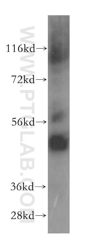 Western Blot (WB) analysis of human heart tissue using MRPS27 Polyclonal antibody (17280-1-AP)