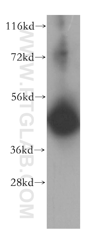 Western Blot (WB) analysis of A431 cells using MRPS27 Polyclonal antibody (17280-1-AP)