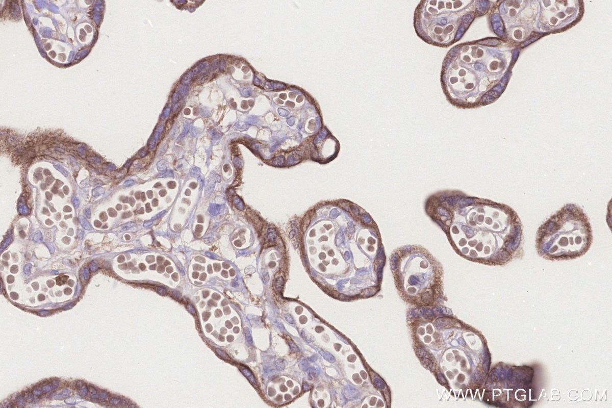 IHC staining of human placenta using 66724-1-Ig Immunohistochemistry (IHC) staining of human placenta tissue using MRPS27 Monoclonal antibody (66724-1-Ig)