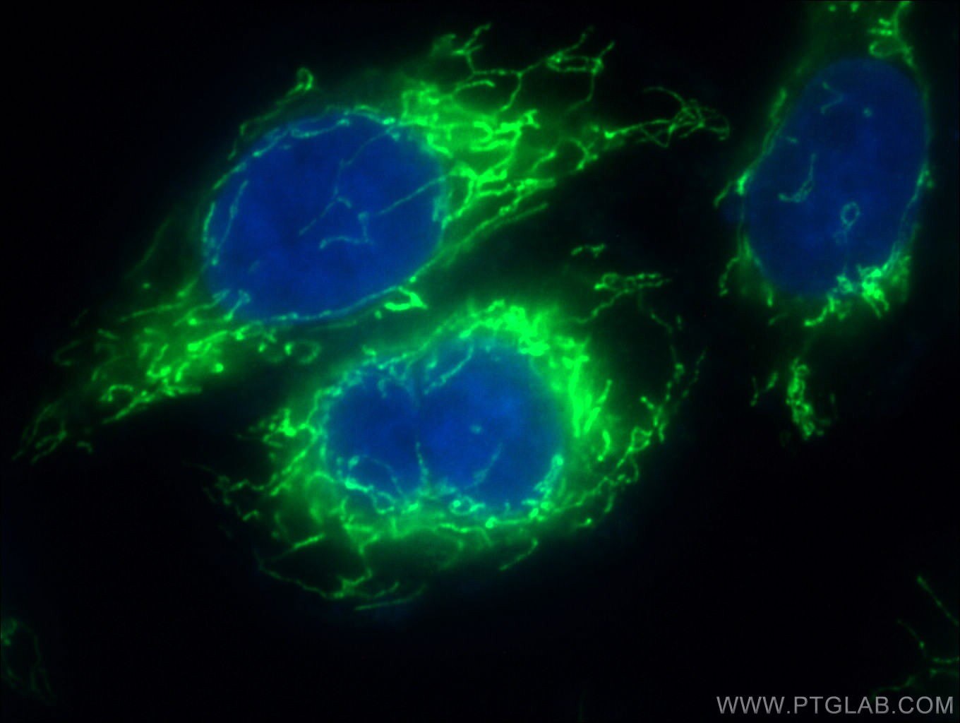 Immunofluorescence (IF) / fluorescent staining of HeLa cells using MRPS28 Polyclonal antibody (16378-1-AP)
