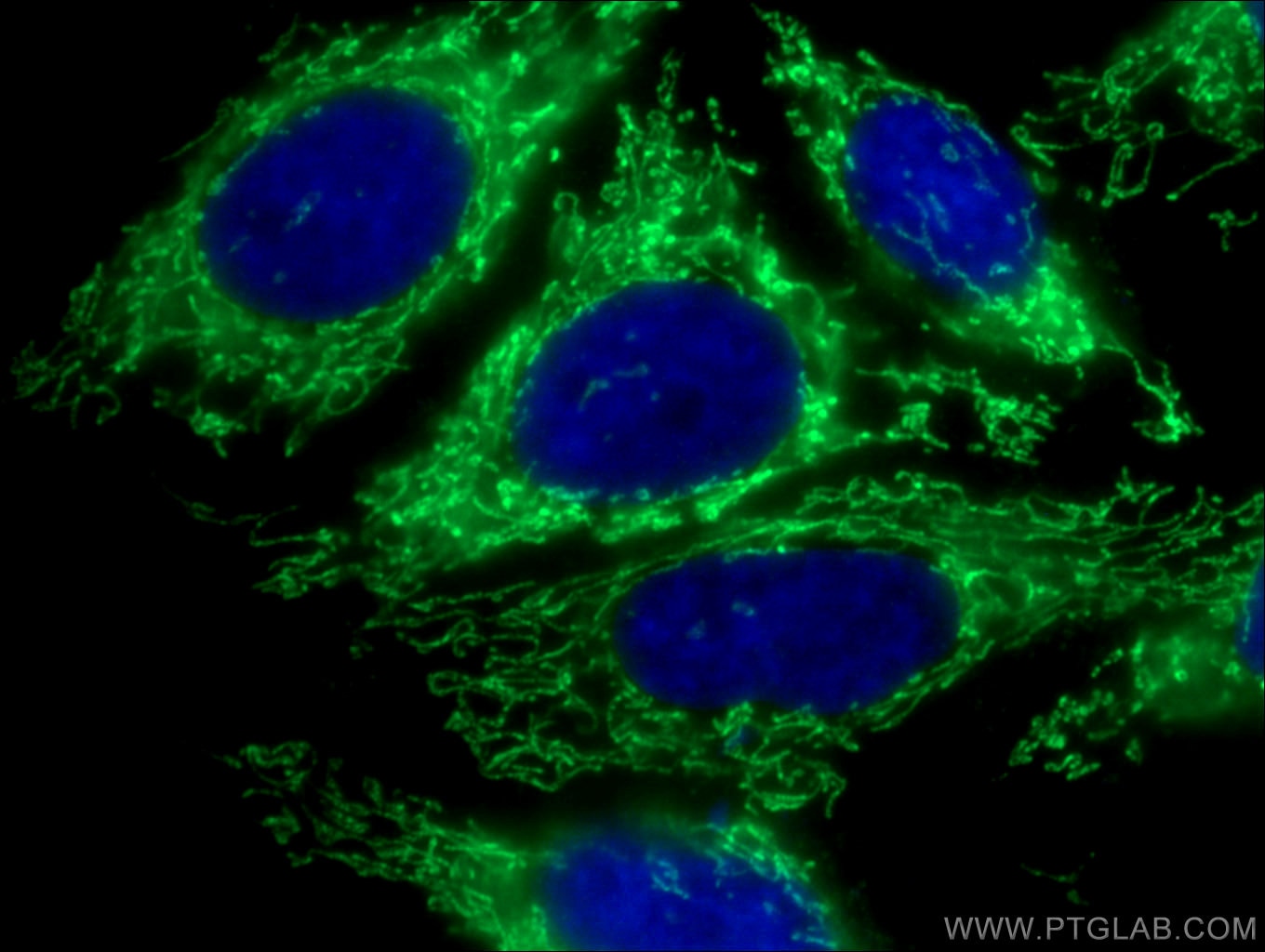 Immunofluorescence (IF) / fluorescent staining of HepG2 cells using MRPS28 Polyclonal antibody (16378-1-AP)