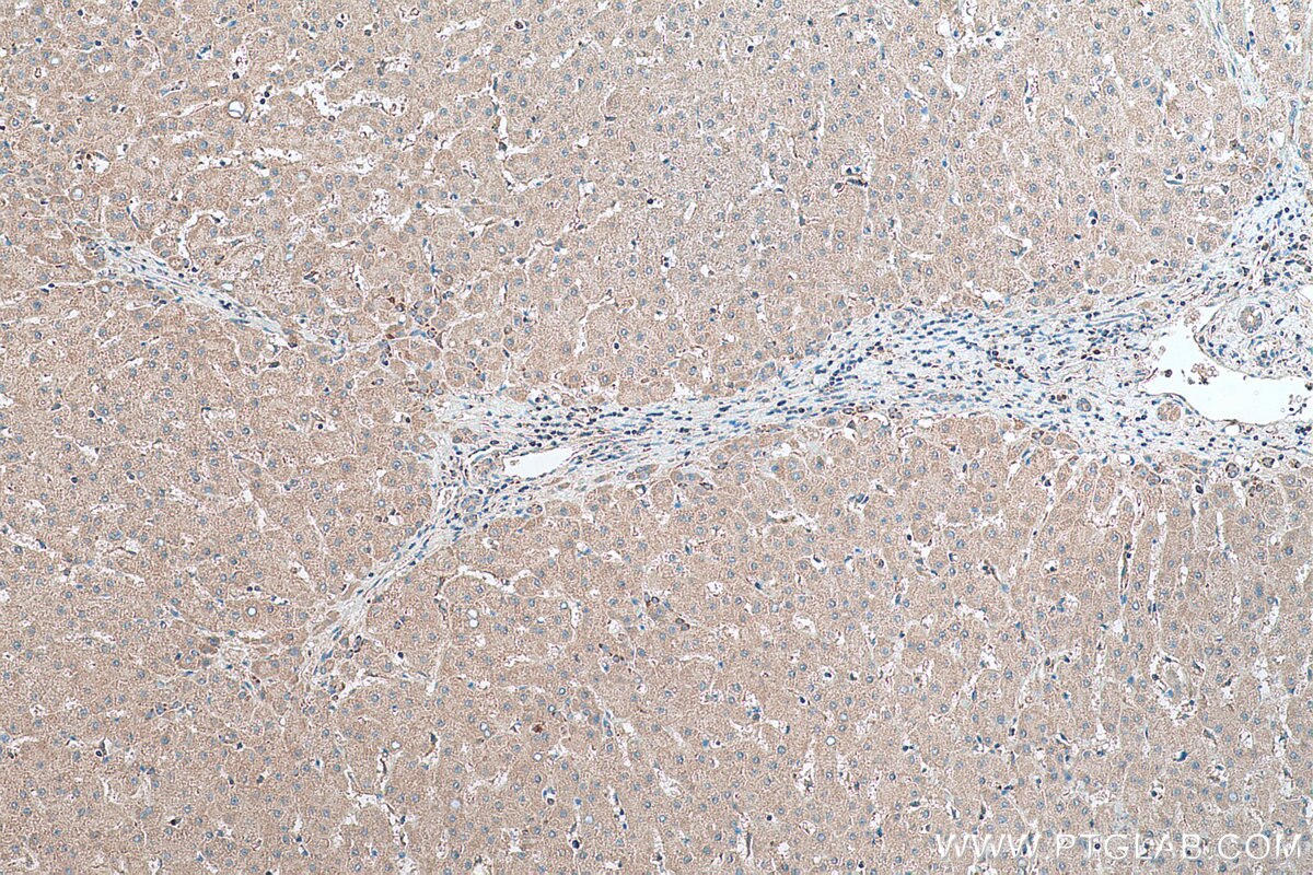 Immunohistochemistry (IHC) staining of human liver tissue using MRPS28 Polyclonal antibody (16378-1-AP)