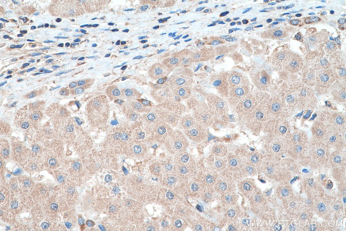Immunohistochemistry (IHC) staining of human liver tissue using MRPS28 Polyclonal antibody (16378-1-AP)