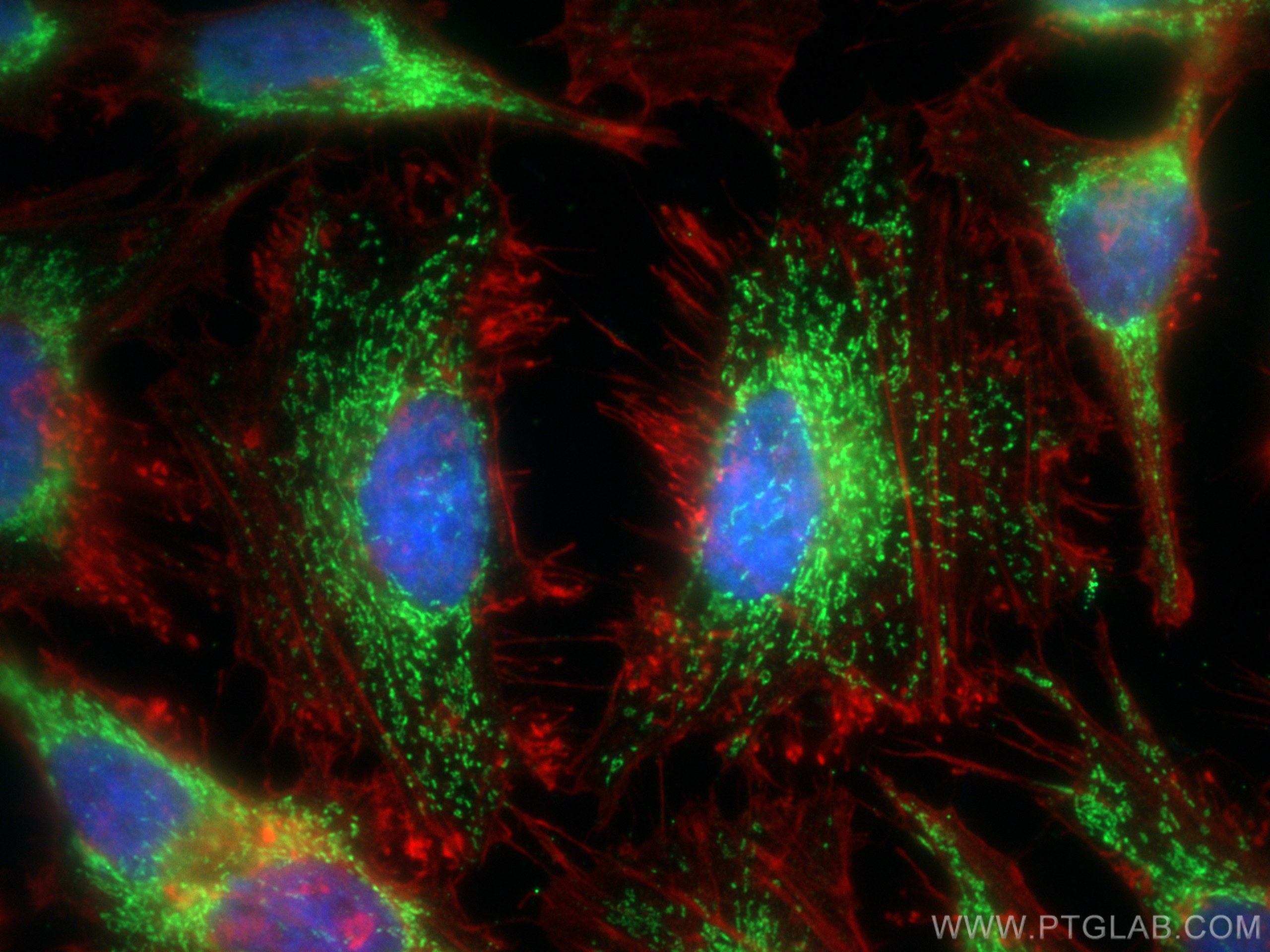 Immunofluorescence (IF) / fluorescent staining of HeLa cells using MRPS31 Polyclonal antibody (16288-1-AP)