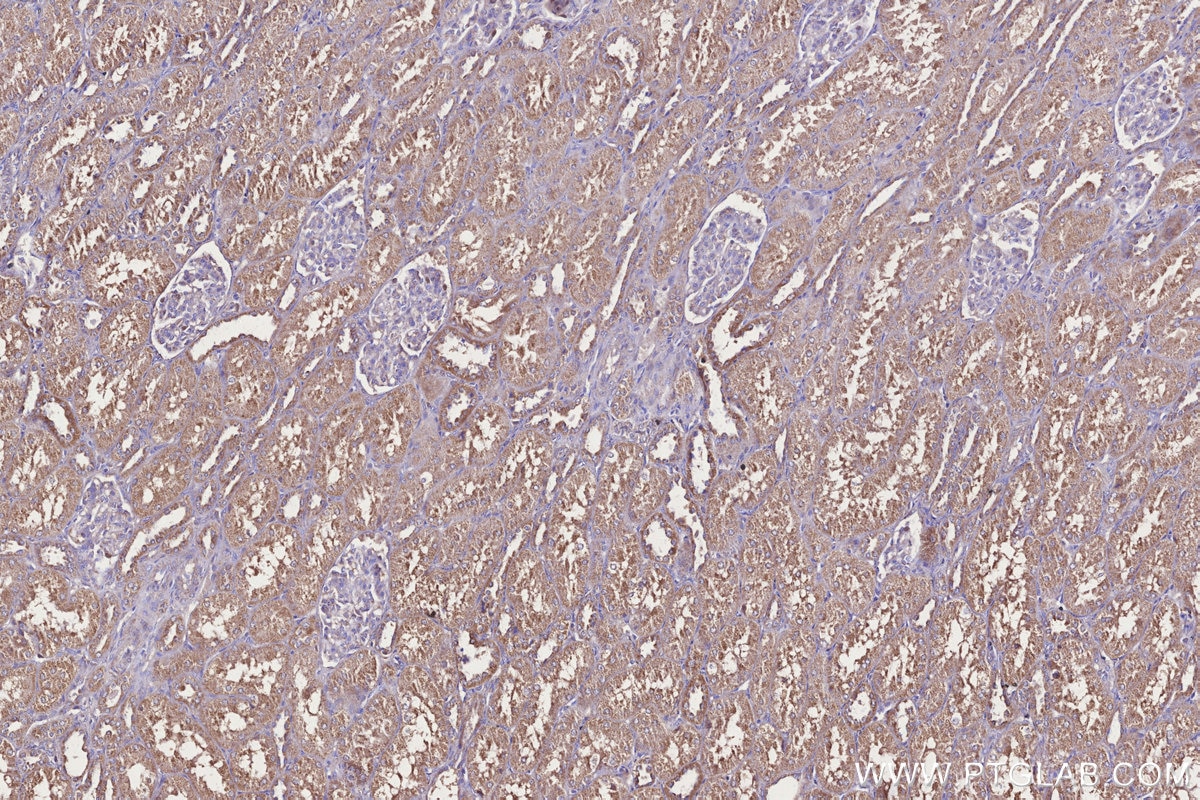 Immunohistochemistry (IHC) staining of human kidney tissue using MRPS31 Polyclonal antibody (16288-1-AP)