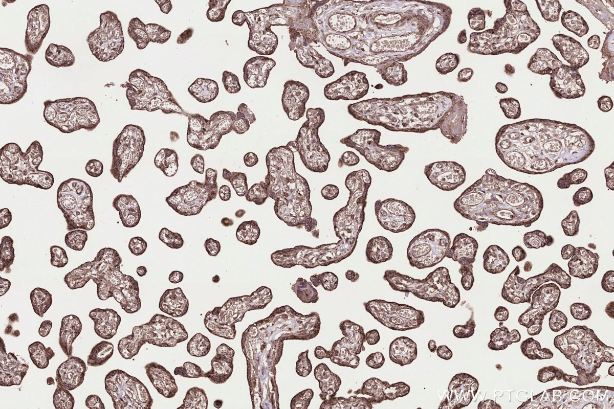 Immunohistochemistry (IHC) staining of human placenta tissue using MRPS31 Polyclonal antibody (16288-1-AP)
