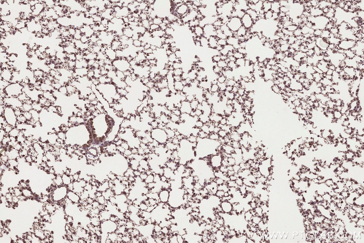 Immunohistochemistry (IHC) staining of mouse lung tissue using MRPS31 Polyclonal antibody (16288-1-AP)
