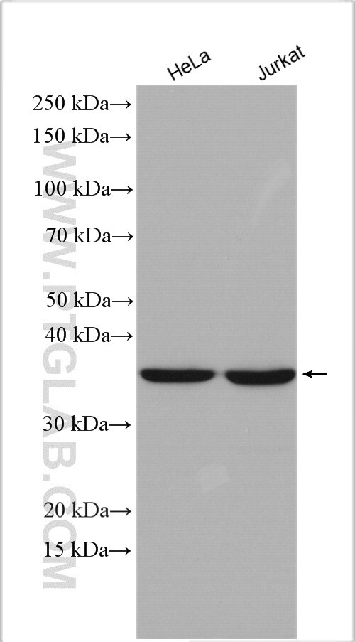 Western Blot (WB) analysis of various lysates using MRPS31 Polyclonal antibody (16288-1-AP)