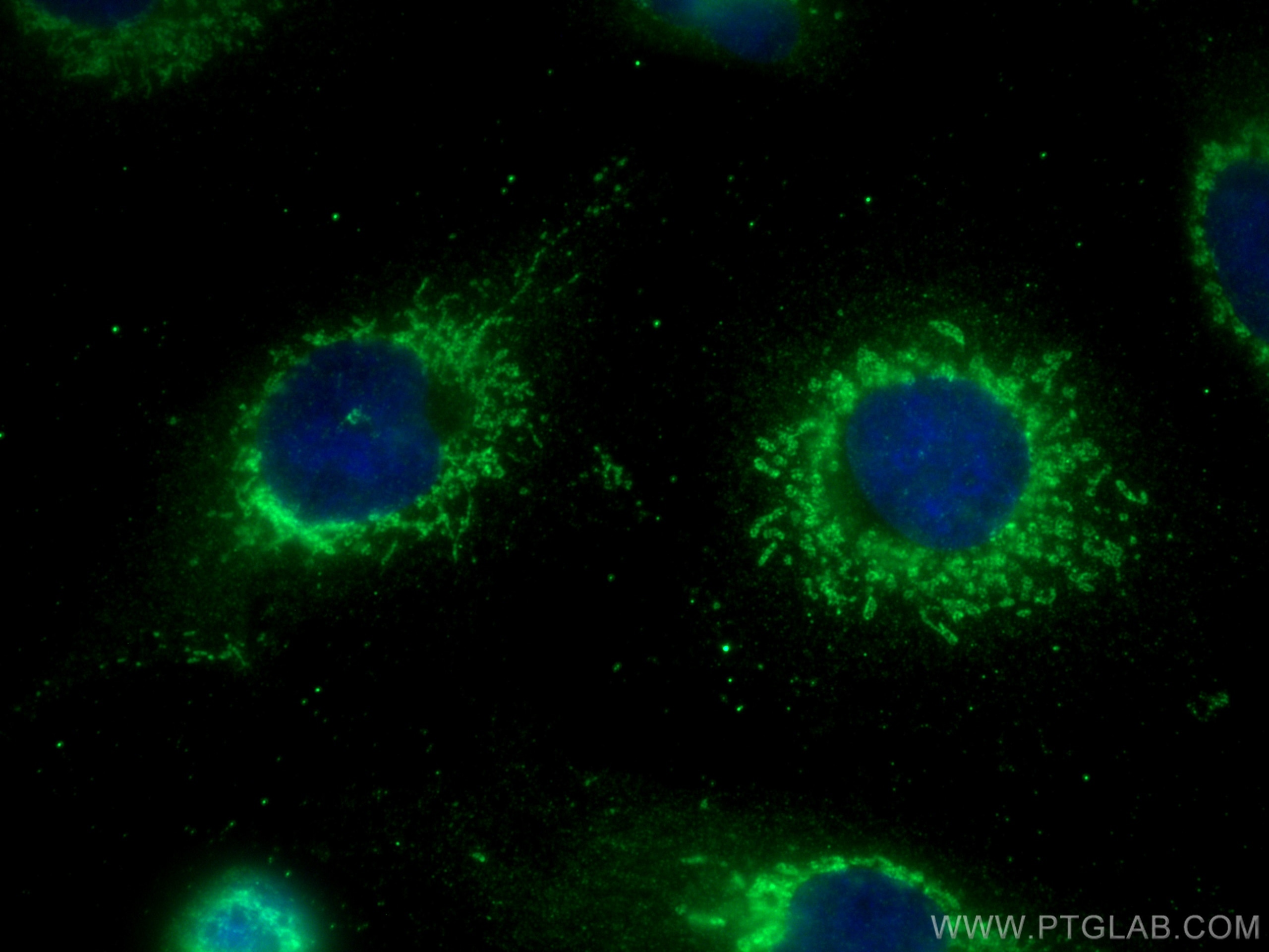 Immunofluorescence (IF) / fluorescent staining of A549 cells using MRPS34 Polyclonal antibody (15166-1-AP)