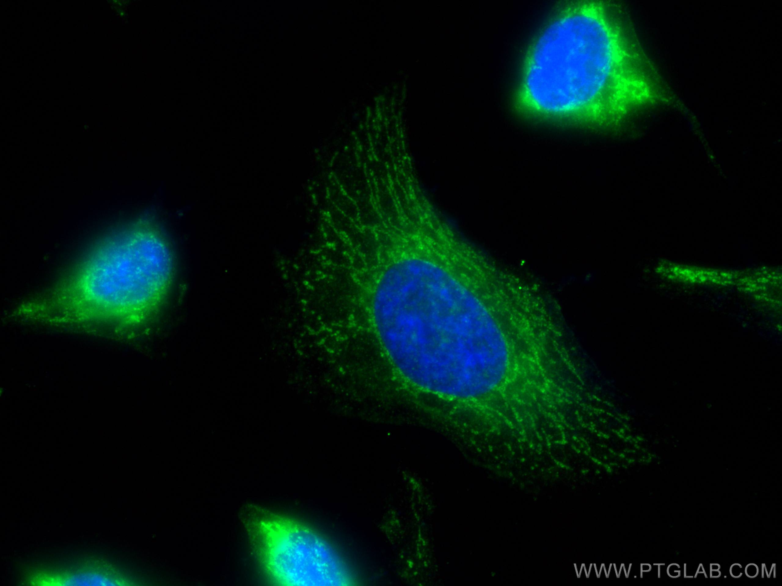 Immunofluorescence (IF) / fluorescent staining of HeLa cells using MRPS35 Polyclonal antibody (16457-1-AP)