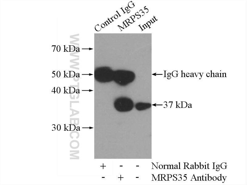 IP experiment of HeLa using 16457-1-AP