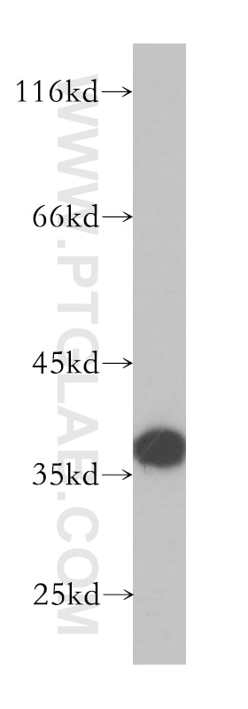 Western Blot (WB) analysis of HeLa cells using MRPS35 Polyclonal antibody (16457-1-AP)