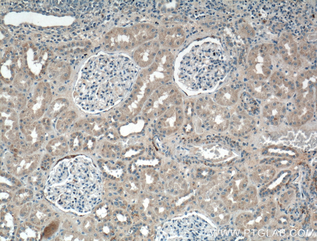 Immunohistochemistry (IHC) staining of human kidney tissue using MRPS5 Polyclonal antibody (16428-1-AP)