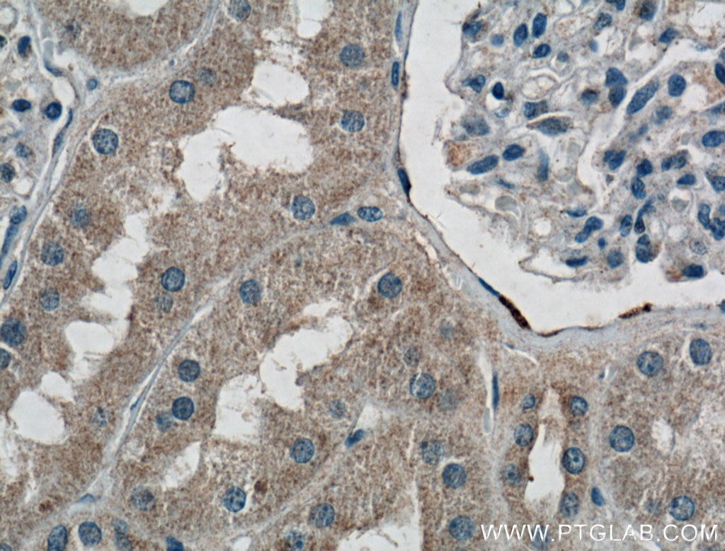 Immunohistochemistry (IHC) staining of human kidney tissue using MRPS5 Polyclonal antibody (16428-1-AP)