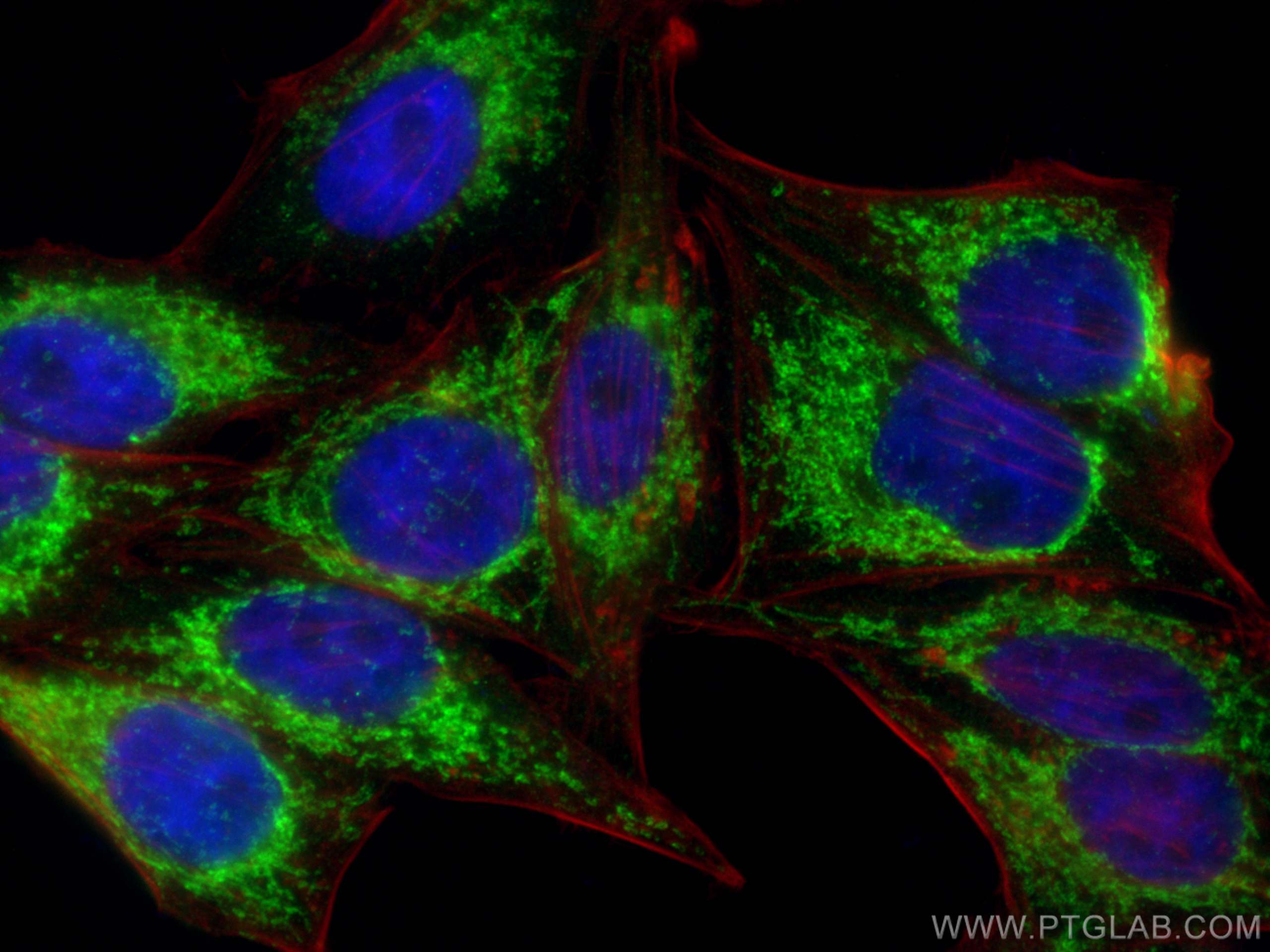 Immunofluorescence (IF) / fluorescent staining of HepG2 cells using MRPS6 Polyclonal antibody (16273-1-AP)