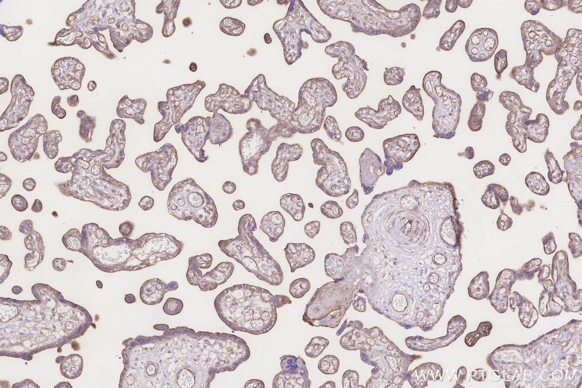 IHC staining of human placenta using 16273-1-AP Immunohistochemistry (IHC) staining of human placenta tissue using MRPS6 Polyclonal antibody (16273-1-AP)