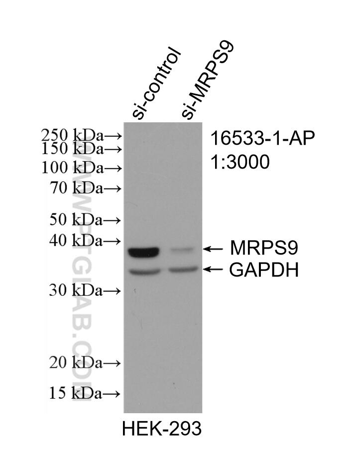 Western Blot (WB) analysis of HEK-293 cells using MRPS9 Polyclonal antibody (16533-1-AP)