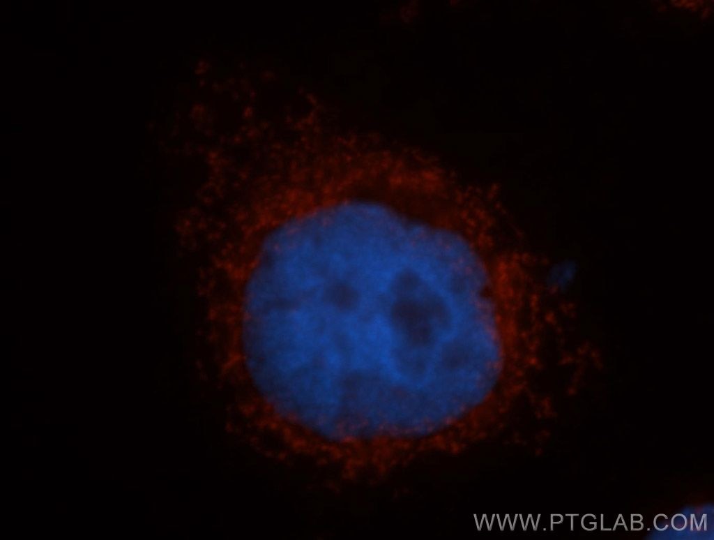 Immunofluorescence (IF) / fluorescent staining of MCF-7 cells using MRRF Polyclonal antibody (12357-2-AP)
