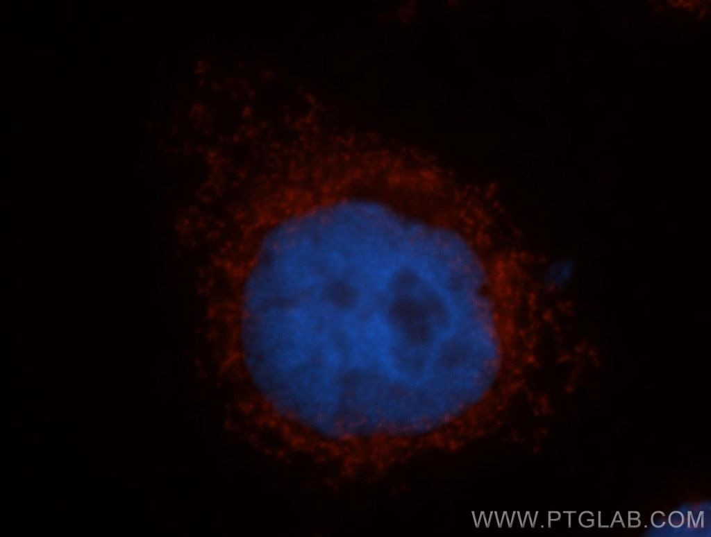 IF Staining of MCF-7 using 12357-2-AP