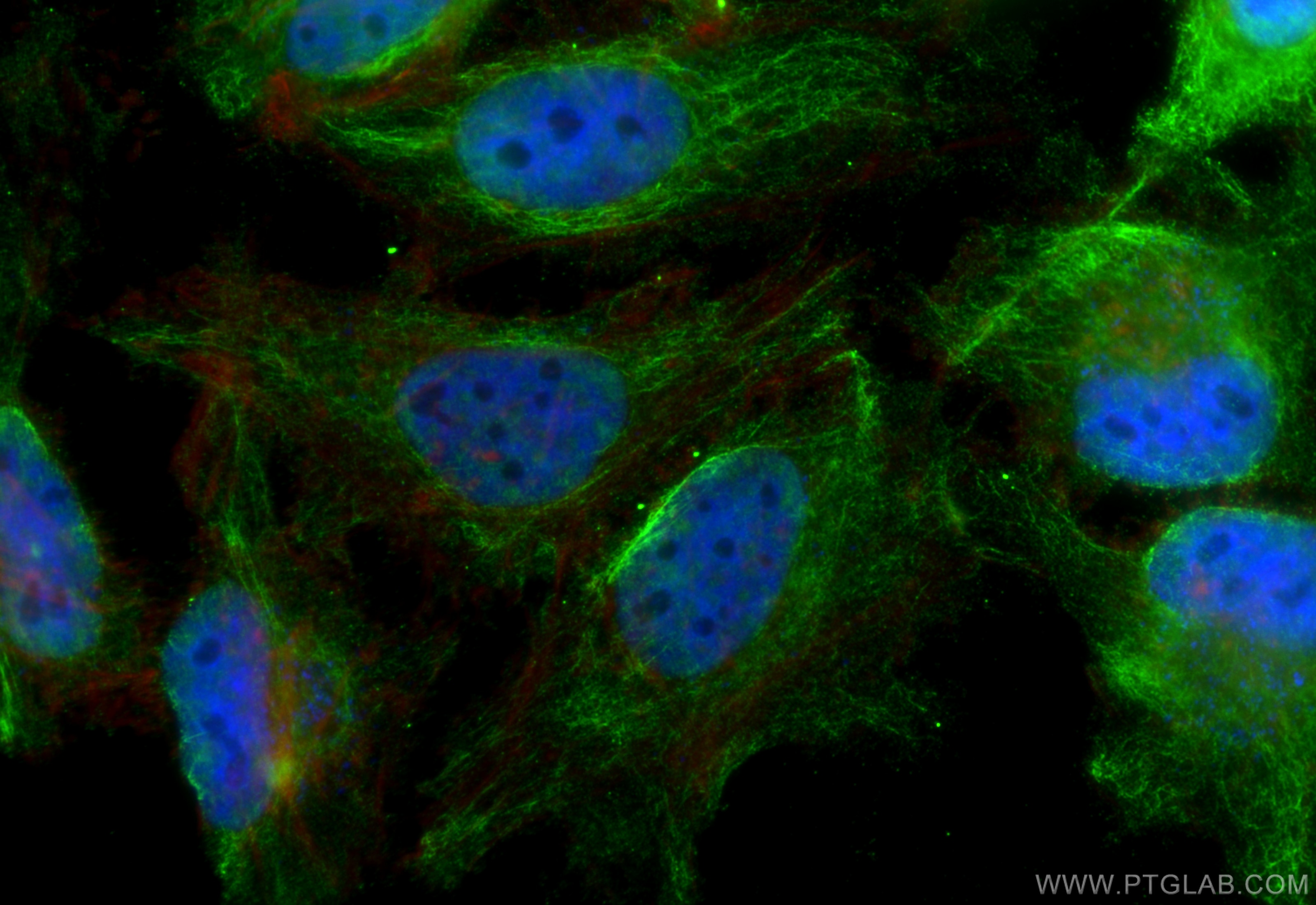 Immunofluorescence (IF) / fluorescent staining of HeLa cells using MRRF Monoclonal antibody (66942-1-Ig)