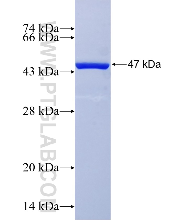 MRS2 fusion protein Ag36607 SDS-PAGE MRS2 fusion protein Ag36607 SDS-PAGE