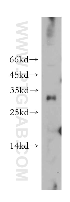 Western Blot (WB) analysis of mouse brain tissue using MRTO4 Polyclonal antibody (20194-1-AP)